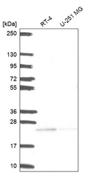 Western blot analysis in human cell line RT-4 and human cell line U-251 MG.