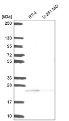Western blot analysis in human cell line RT-4 and human cell line U-251 MG.