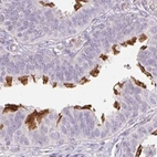 Immunohistochemical staining of human fallopian tube using Anti-TMEM237 antibody HPA052596.