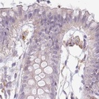Immunohistochemical staining of human colon using Anti-TMEM237 antibody HPA052596.