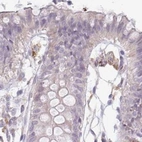 Immunohistochemical staining of human colon using Anti-TMEM237 antibody HPA052596.