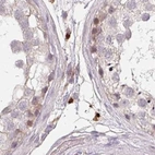 Immunohistochemical staining of human testis using Anti-TMEM237 antibody HPA052596.