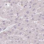 Immunohistochemical staining of human liver using Anti-TMEM237 antibody HPA052596.