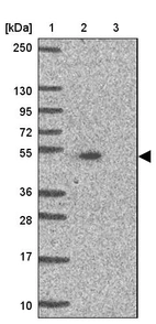 Lane 1: Marker [kDa] 250, 130, 95, 72, 55, 36, 28, 17, 10_br/_Lane 2: Human cell line RT-4_br/_Lane 3: Human cell line U-251MG sp