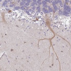 Anti-WSB2 Antibody