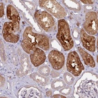 Anti-CTDSP2 Antibody