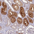 Anti-CTDSP2 Antibody