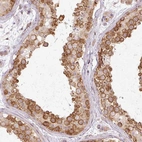 Anti-MZT2A Antibody
