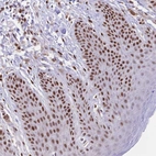 Immunohistochemical staining of human squamous epithelia shows strong nuclear positivity in squamous epithelial cells.