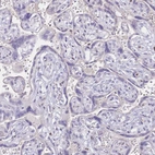 Immunohistochemical staining of human placenta shows no positivity in trophoblastic cells as expected.