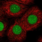 Immunofluorescent staining of human cell line MCF7 shows localization to nucleus & nucleoli fibrillar center.