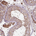 Anti-MAGEB5 Antibody