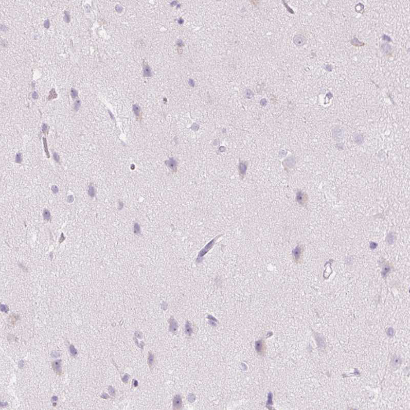 Anti-CMA1 Antibody