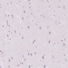 Anti-CMA1 Antibody