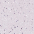Anti-CMA1 Antibody