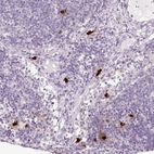 Immunohistochemical staining of human lymph node shows strong cytoplasmic positivity in mast cell.