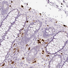 Anti-CMA1 Antibody