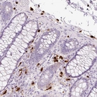 Immunohistochemical staining of human colon shows strong cytoplasmic positivity in mast cell.