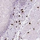 Immunohistochemical staining of human esophagus shows strong cytoplasmic positivity in mast cell.