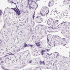 Anti-CMA1 Antibody