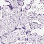Immunohistochemical staining of human placenta shows no positivity in trophoblastic cells as expected.