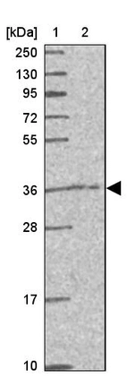 Lane 1: Marker [kDa] 250, 130, 95, 72, 55, 36, 28, 17, 10_br/_Lane 2: Human cell line RT-4