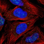 Immunofluorescent staining of human cell line U-2 OS shows localization to nucleus, nucleoli & vesicles.