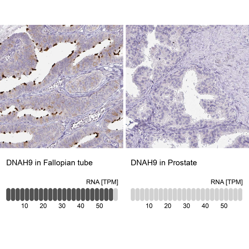 Anti-DNAH9 Antibody