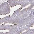 Immunohistochemical staining of human fallopian tube shows strong positivity in cilia in glandular cells.
