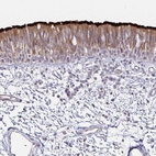 Immunohistochemical staining of human bronchus shows strong positivity in respiratory epithelial cells.