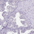 Immunohistochemical staining of human prostate shows no positivity in glandular cells as expected.