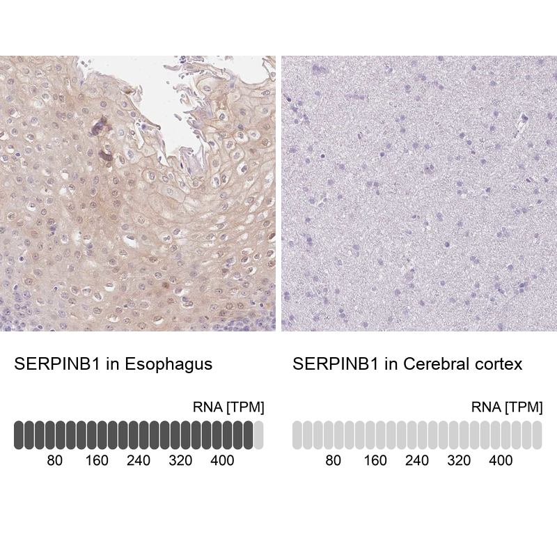 Anti-SERPINB1 Antibody
