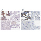 Immunohistochemical staining of human bone marrow, kidney, liver and testis using Anti-SERPINB1 antibody HPA052642 (A) shows similar protein distribution across tissues to independent antibody HPA018871 (B).