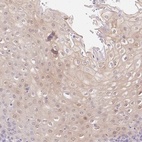 Immunohistochemical staining of human esophagus shows high expression.