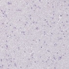 Immunohistochemical staining of human cerebral cortex shows low expression as expected.