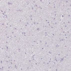 Immunohistochemical staining of human cerebral cortex shows low expression as expected.