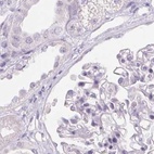 Immunohistochemical staining of human kidney using Anti-SERPINB1 antibody HPA052642.