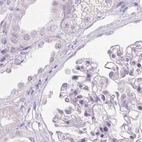 Immunohistochemical staining of human kidney using Anti-SERPINB1 antibody HPA052642.