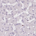 Anti-SERPINB1 Antibody