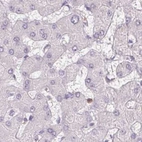 Immunohistochemical staining of human liver using Anti-SERPINB1 antibody HPA052642.