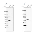 Western blot analysis using Anti-SERPINB1 antibody HPA052642 (A) shows similar pattern to independent antibody HPA018871 (B).