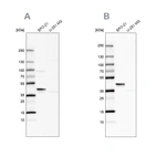 Western blot analysis using Anti-SERPINB1 antibody HPA052642 (A) shows similar pattern to independent antibody HPA018871 (B).