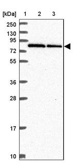 Lane 1: Marker [kDa] 250, 130, 95, 72, 55, 36, 28, 17, 10_br/_Lane 2: Human cell line RT-4_br/_Lane 3: Human cell line U-251 MG