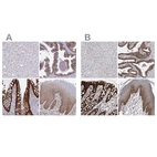 Immunohistochemical staining of human liver, prostate, rectum and squamous epithelia using Anti-LIMA1 antibody HPA052645 (A) shows similar protein distribution across tissues to independent antibody HPA023871 (B).