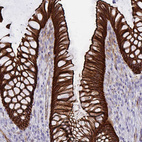 Immunohistochemical staining of human rectum shows strong membranous and cytoplasmic positivity in glandular cells.