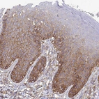 Immunohistochemical staining of human skin shows moderate membranous and cytoplasmic positivity in squamous epithelial cells.