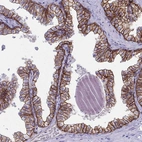 Immunohistochemical staining of human prostate shows strong membranous positivity in glandular cells.