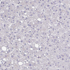 Immunohistochemical staining of human liver shows very weak membranous positivity in hepatocytes.