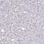 Immunohistochemical staining of human liver shows very weak membranous positivity in hepatocytes.