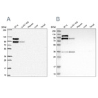 Anti-LIMA1 Antibody